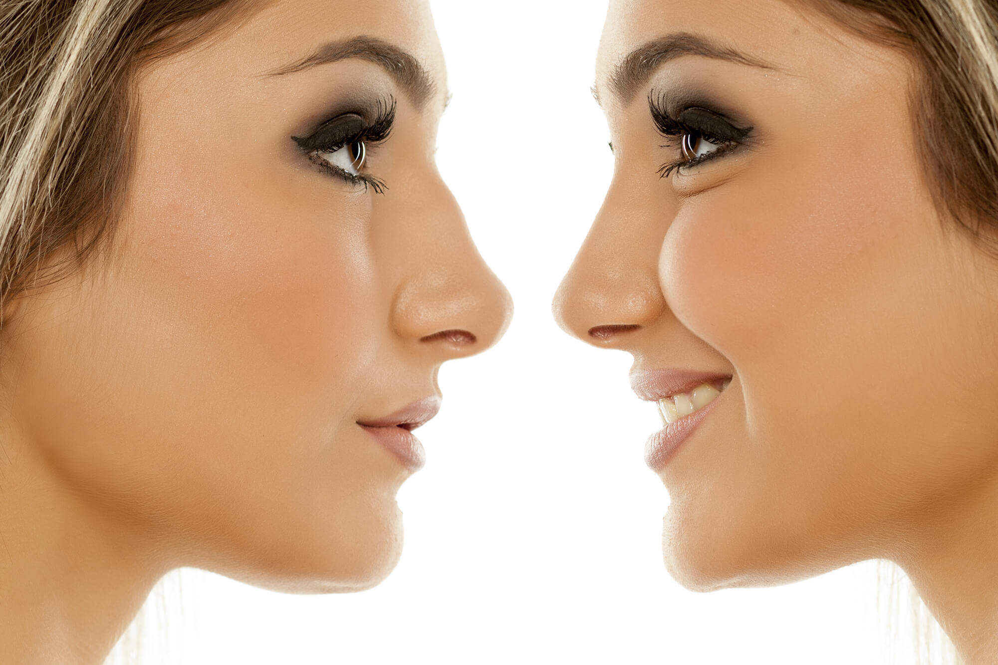 Close Up of Two Women Looking at Each Other - Left Side is Before Rhinoplasty and Right Side is After